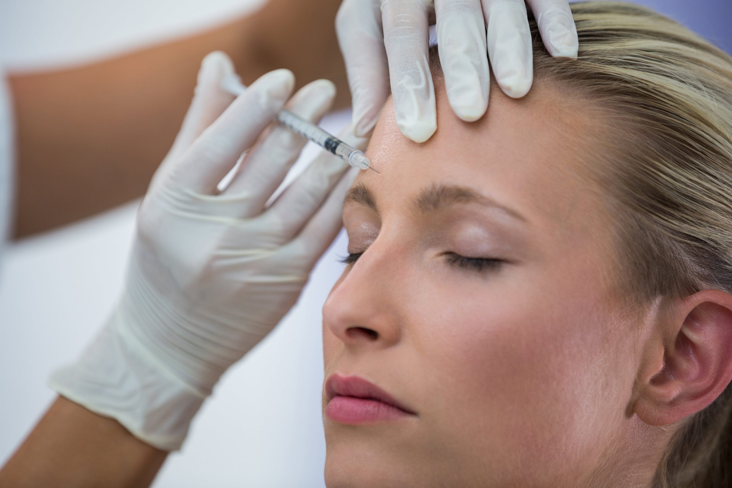 How Does Radiesse Work Collagen Stimulation & Longevity
