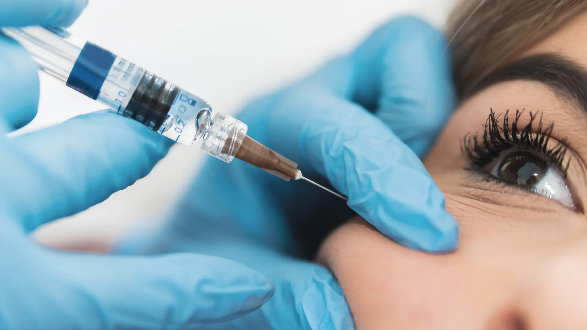 Radiese Injections Procedure, Results, and Recovery Guide