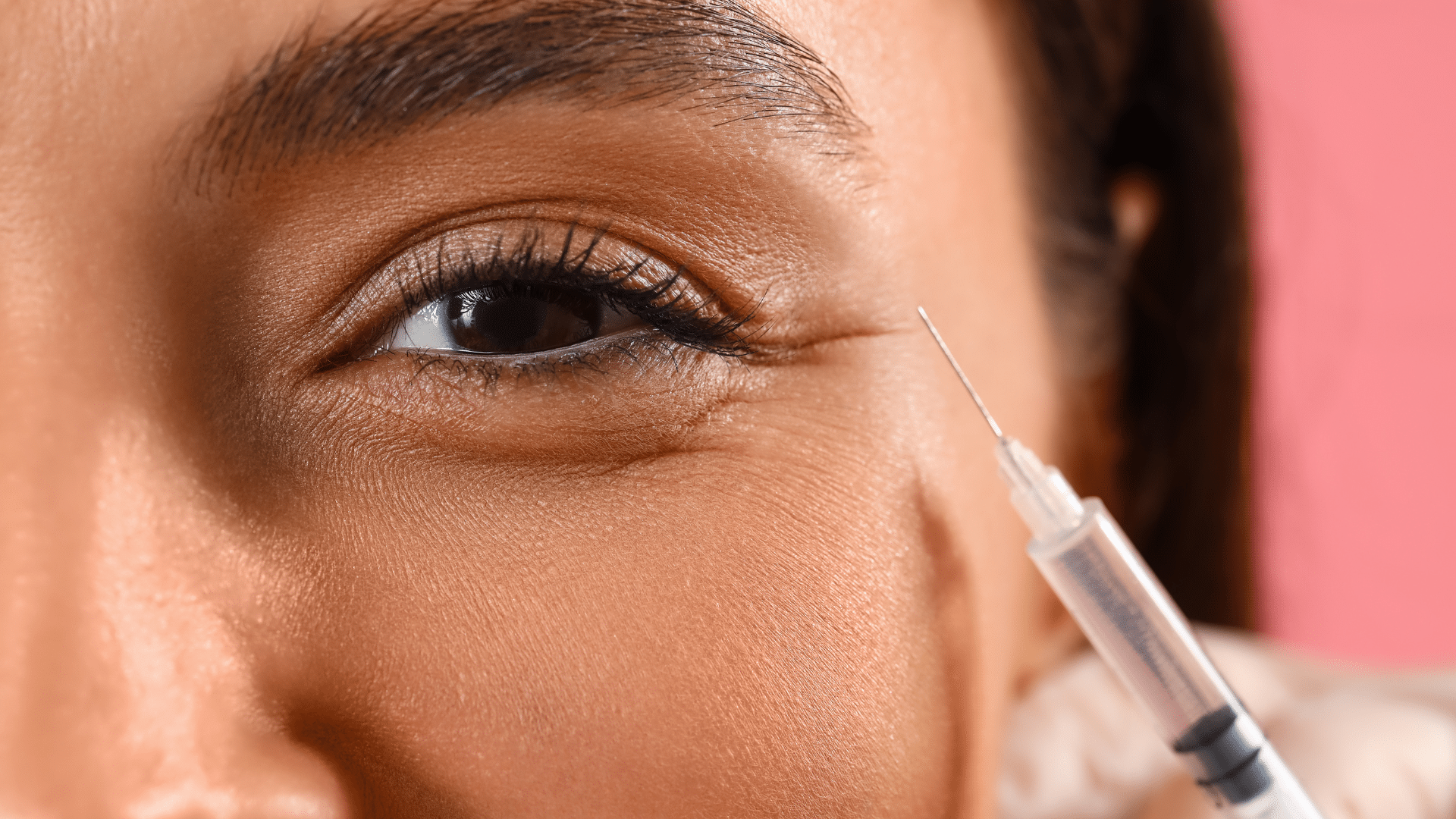 Radiesse vs. Juvederm Key Differences, Best For, & Lasting Duration