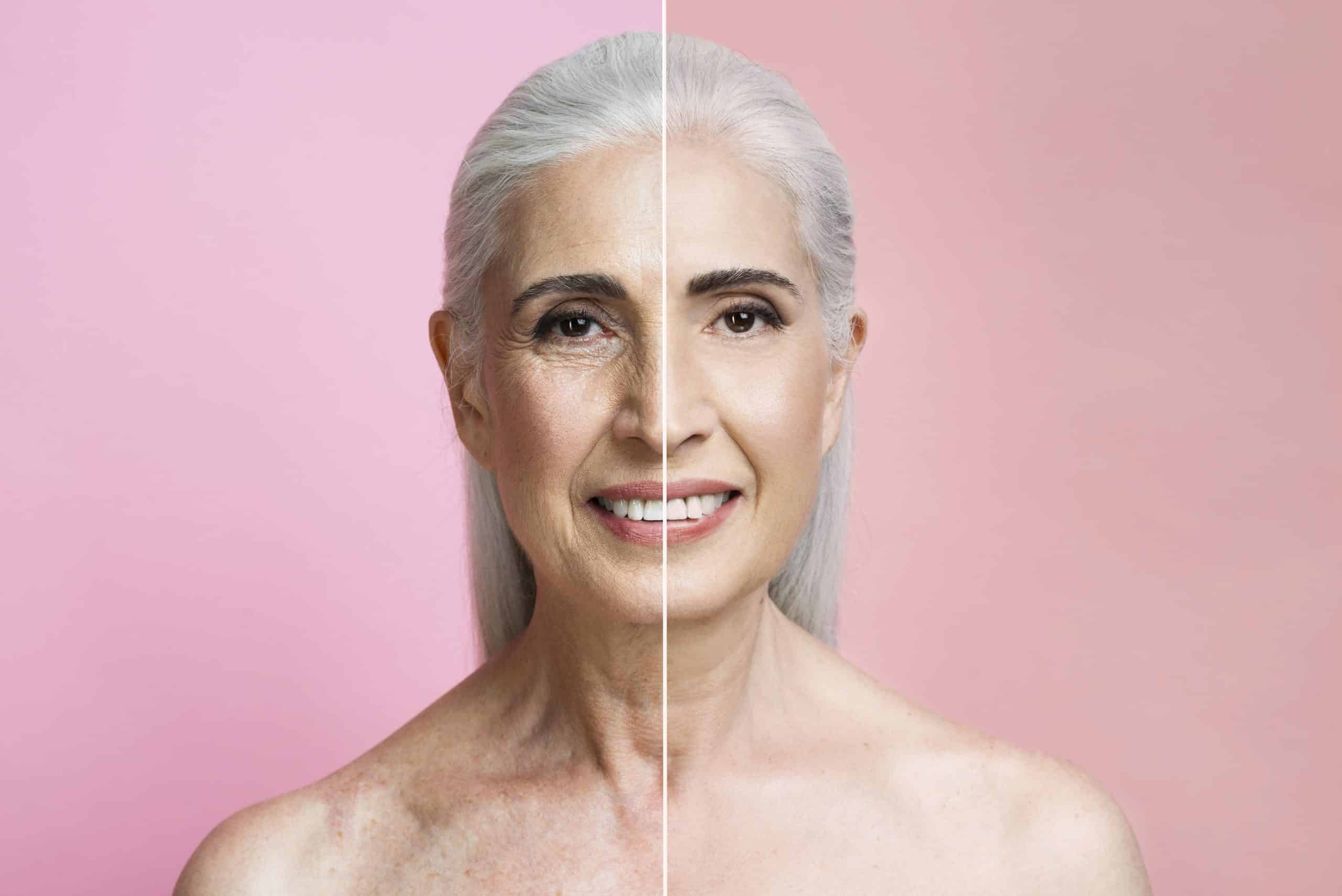 Hyaron vs Curenex Glow Moisture Retention, Skin Quality, and Results