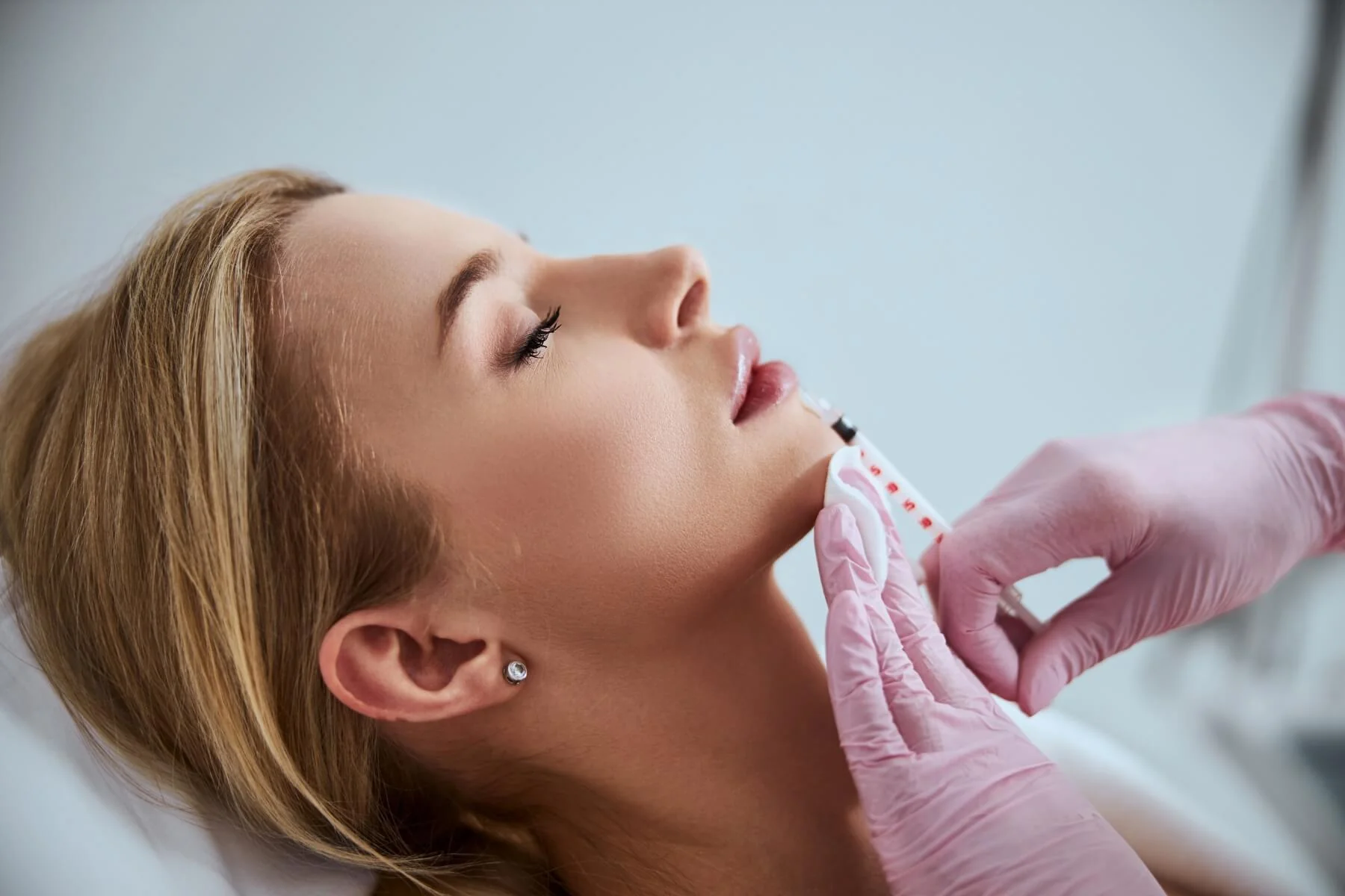 Restylane vs Juvederm Which Filler is Right for You