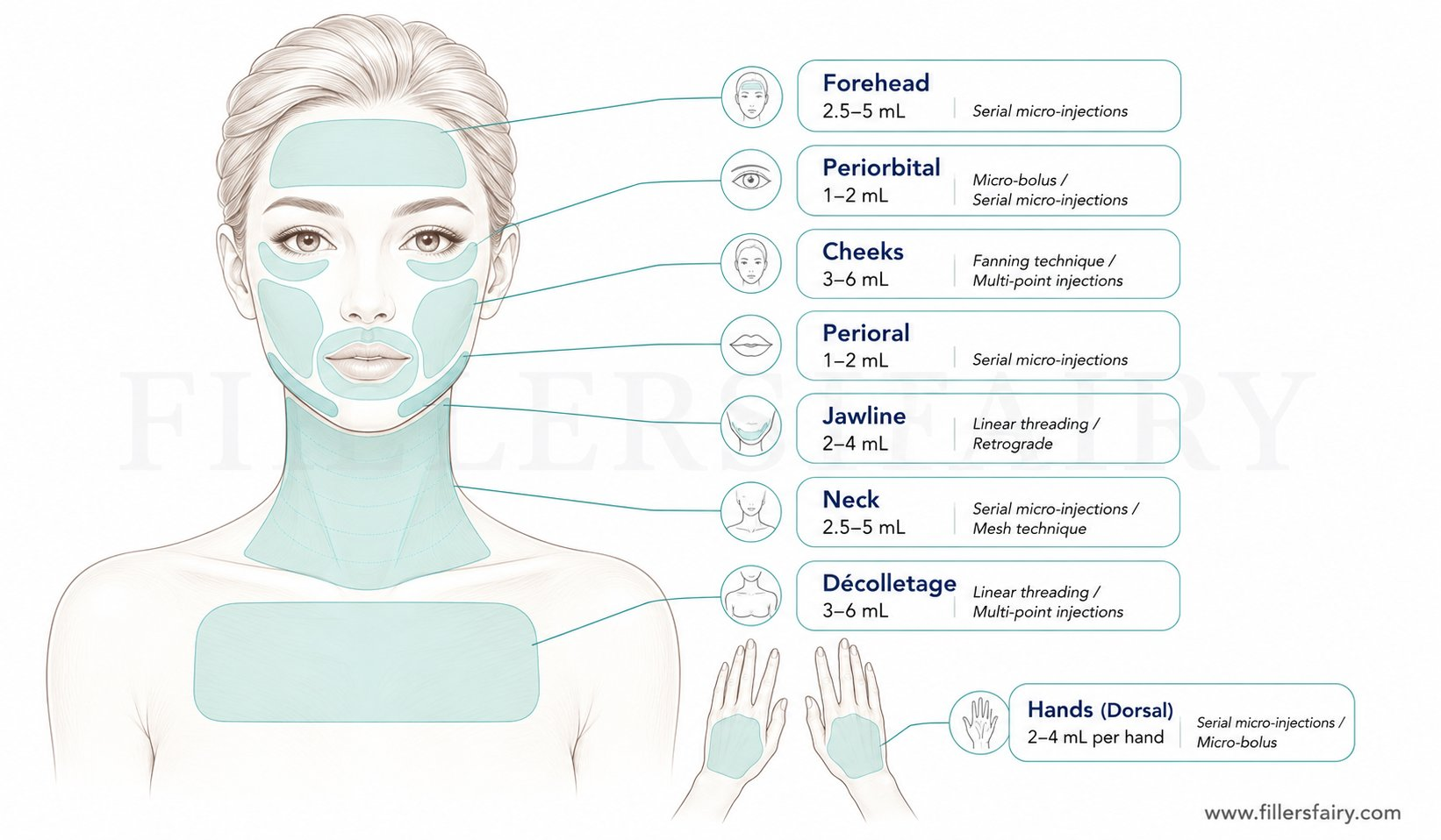 Hyaron treatment area map showing injection zones: full face, forehead, periorbital, cheeks, perioral, neck, décolletage, and hands