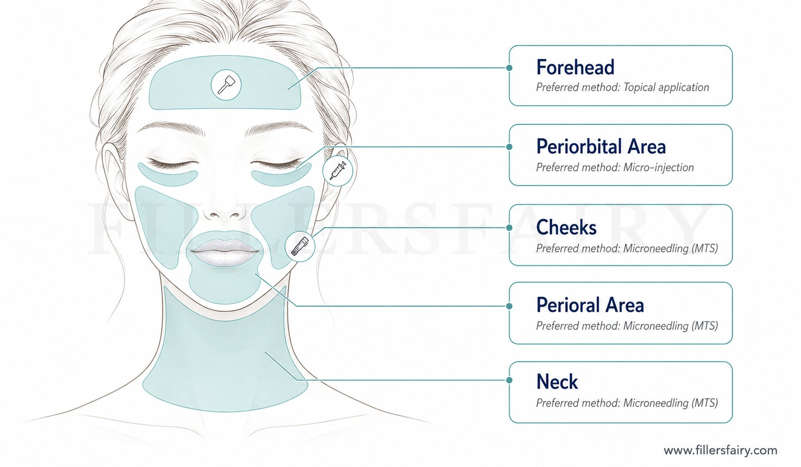 Curenex Glow treatment area map showing zones: full face, forehead, periorbital, cheeks, perioral, neck, and décolletage with delivery method annotations