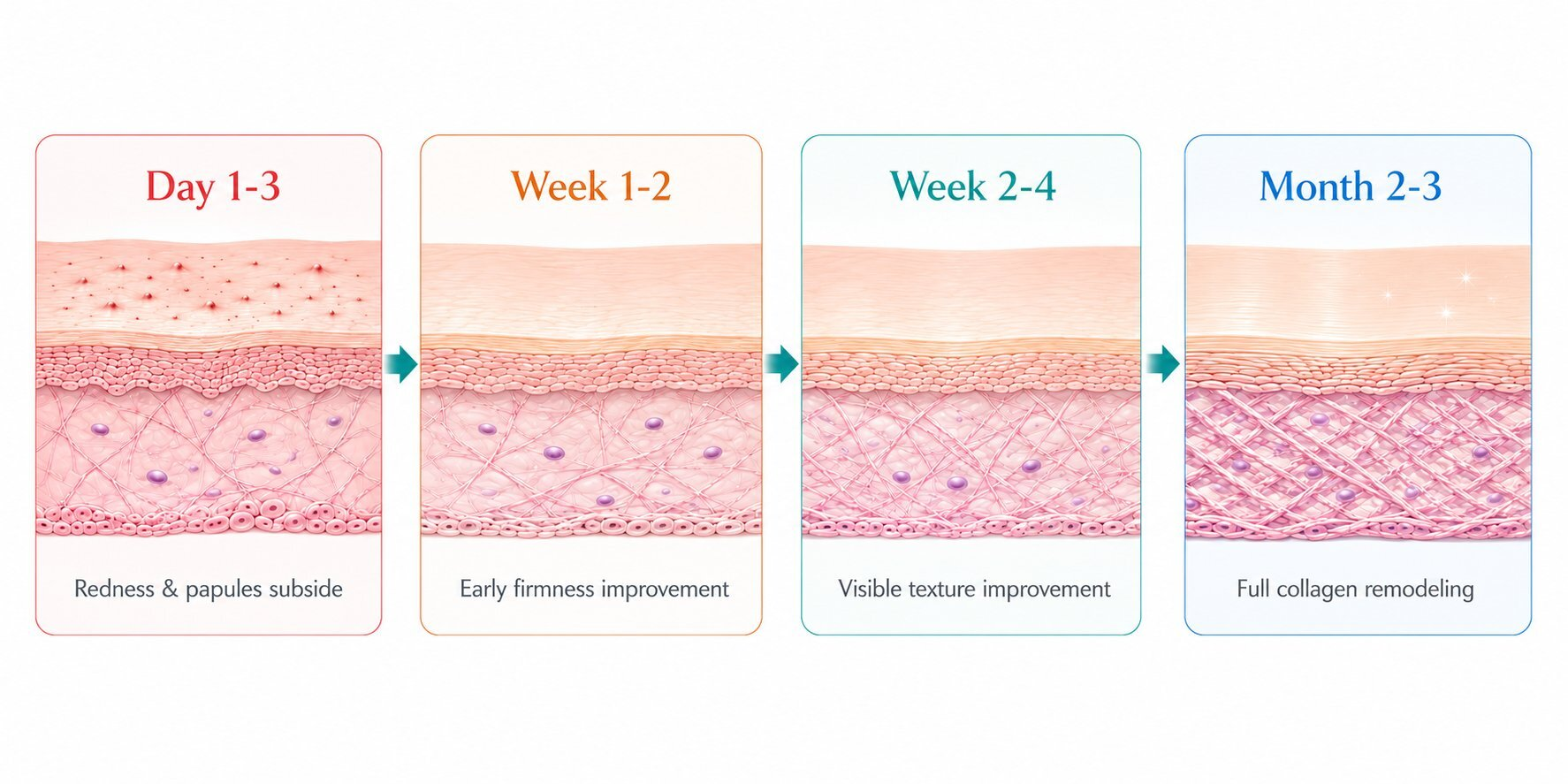 Rejuran recovery timeline from Day 1-3 through Month 2-3 showing skin healing progression