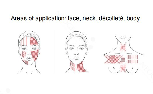 Neogenesis Mono Thread areas of application diagram showing treatment zones on the face, neck and décolleté