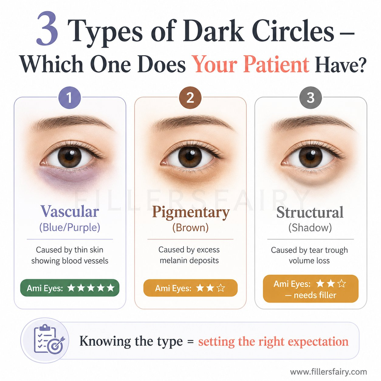 3 types of dark circles — vascular, pigmentary, structural — which one does your patient have