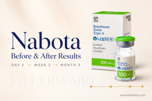 Nabota before and after results timeline — visible improvement from Day 2 through Month 6