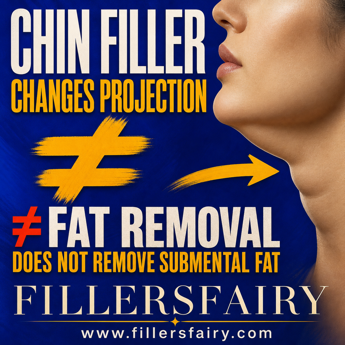 Chin filler can change profile projection but does not remove submental fat