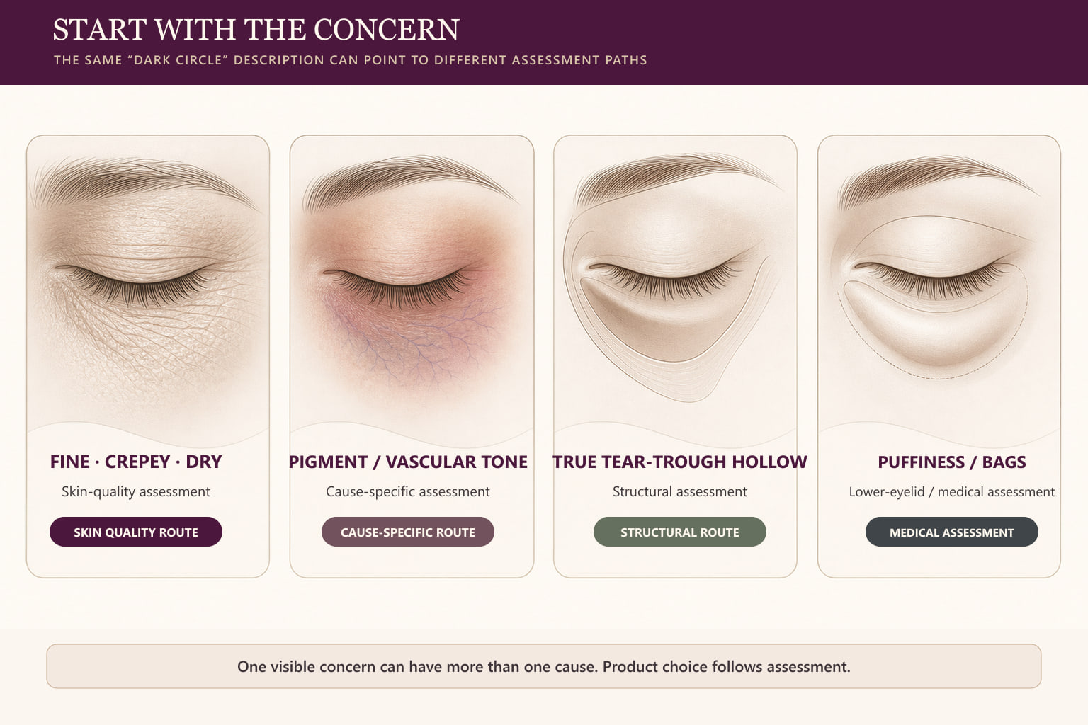 Under-eye concern map separating skin texture discoloration structural hollows and persistent bags into different assessment paths