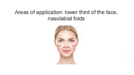 Neogenesis Mesh Thread areas of application: lower third of the face and nasolabial folds