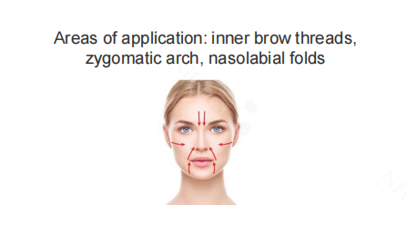 Neogenesis Thread Filler areas of application: inner brow, zygomatic arch and nasolabial folds