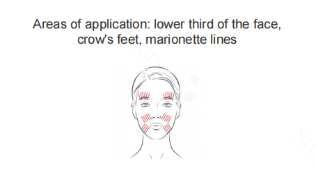 Neogenesis Twin Multi Thread areas of application: lower third of the face, crow’s feet and marionette lines